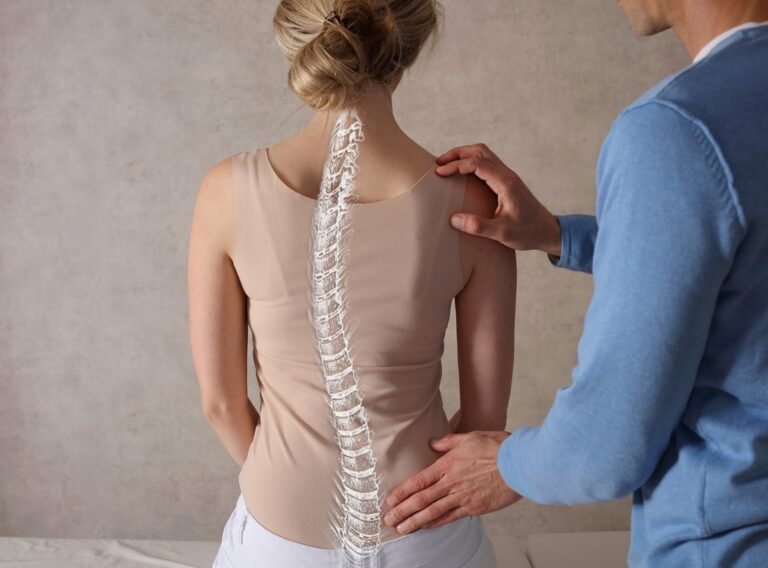 Scoliosis,Spine,Curve,Anatomy,,Posture,Correction.,Chiropractic,Treatment,,Back,Pain